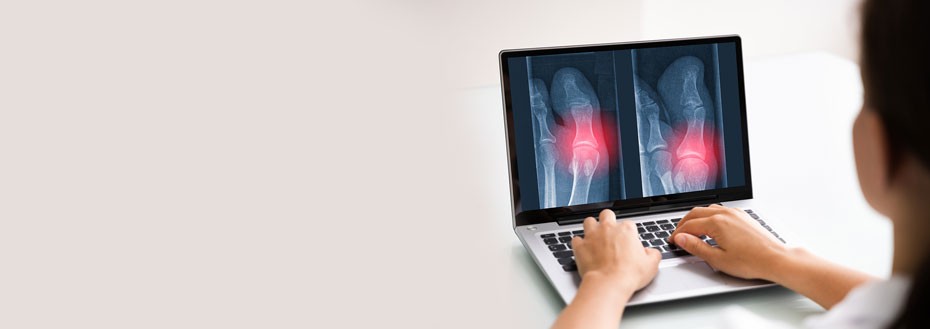 Bone Density Scan Services